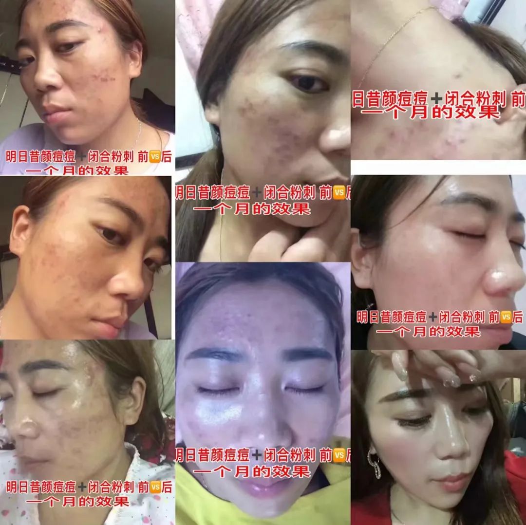 案例1.jpg
